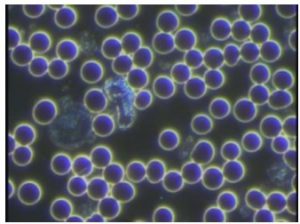 %e8%a1%80%e6%b6%b2%e3%82%b5%e3%83%a9%e3%82%b5%e3%83%a9%ef%bc%91-%ef%bc%91