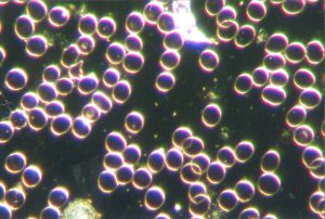 %e8%b2%a7%e8%a1%80%ef%bc%9f